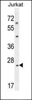 CLDN22 antibody