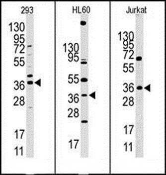 HIF1AN antibody