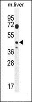 DTWD2 antibody