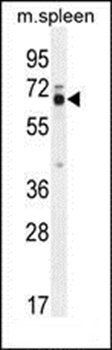 LMOD2 antibody