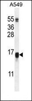 WFDC12 antibody