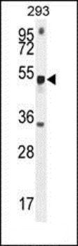 METTL4 antibody