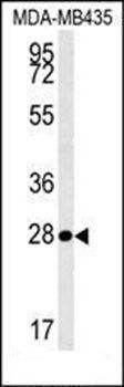 MRM1 antibody