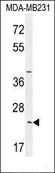 SYCE2 antibody