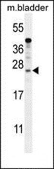 KIAA1644 antibody
