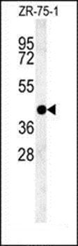 PSG9 antibody