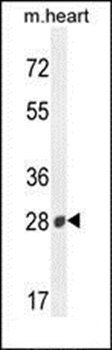 B3GAT2 antibody