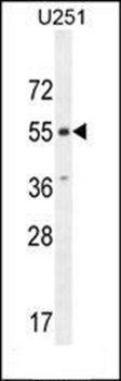 CMKOR1 antibody