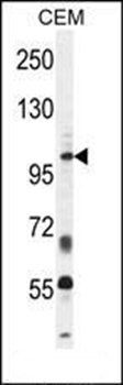 INPP5B antibody