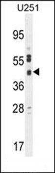 CB018 antibody