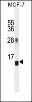 AVPI1 antibody