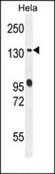 DEN5A antibody