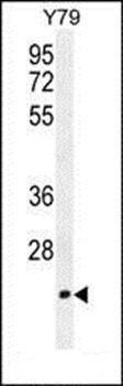 TCAL3 antibody