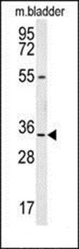 LRC18 antibody