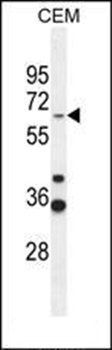 ZNF667 antibody