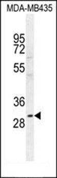 CLEC10A antibody