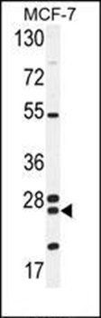 NUDT8 antibody