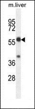 TBCCD1 antibody