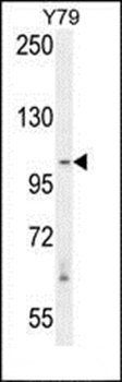 RASAL3 antibody