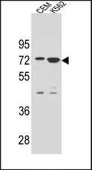 ZNF324B antibody
