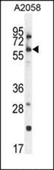 CCDC148 antibody