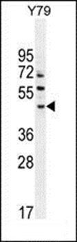 LACE1 antibody