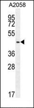 WDR21C antibody