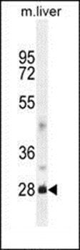DNAJB8 antibody
