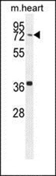 CCDC38 antibody