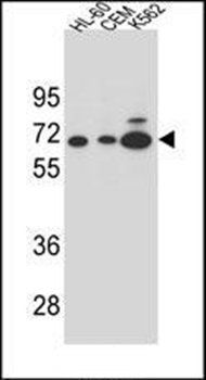 AMY2B antibody