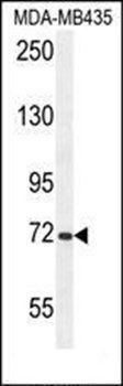 ARHGAP10 antibody