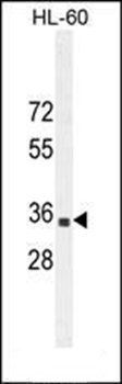 B3GNT4 antibody