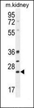 BCL10 antibody