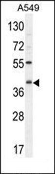 C5AR1 antibody
