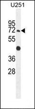 GPAA1 antibody
