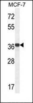 GPD1L antibody