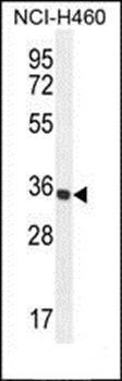 PRSS1 antibody