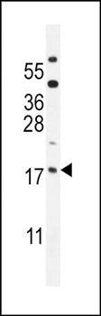 ORMDL3 antibody