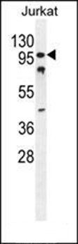 CWC22 antibody