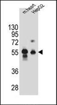 DPEP3 antibody