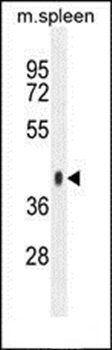 SYTL3 antibody