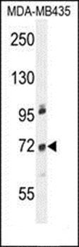 ZNF510 antibody