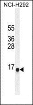 SPAG11A antibody