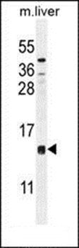 CCDC126 antibody
