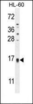 TCL6 antibody