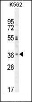 OR2M3 antibody