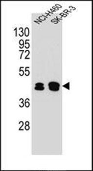KRT80 antibody