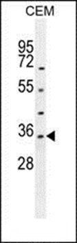 LDHAL6A antibody