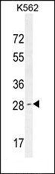 OR52D1 antibody