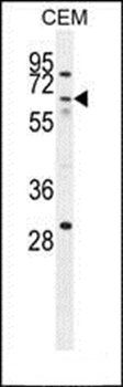 ZNF674 antibody